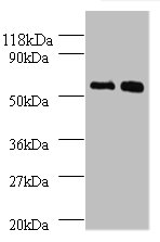 BMP3 Polyclonal Antibody (100 µl)