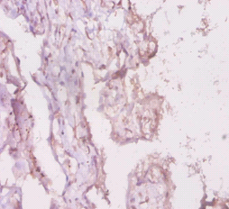LRBA Polyclonal Antibody