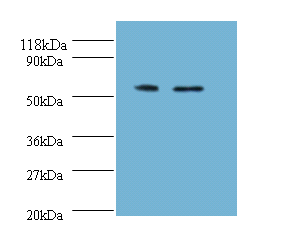 CS Polyclonal Antibody