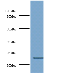 Gstp1 Polyclonal Antibody