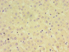 AFP Polyclonal Antibody (100 µl)