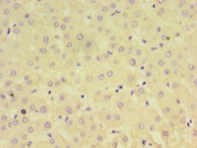 AFP Polyclonal Antibody