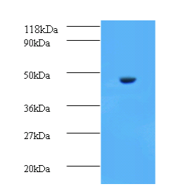 GOT1 Polyclonal Antibody