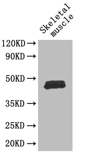 FOXP3 Polyclonal Antibody (100 µl)