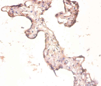 RPL3 Polyclonal Antibody