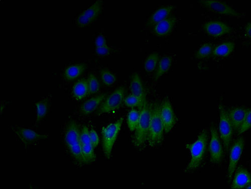 GLIPR1 Polyclonal Antibody