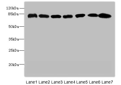 CAPN2 Polyclonal Antibody