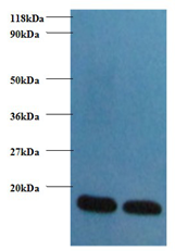 FABP3 Polyclonal Antibody