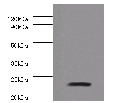 JAM2 Polyclonal Antibody