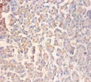 GRIN2A Polyclonal Antibody