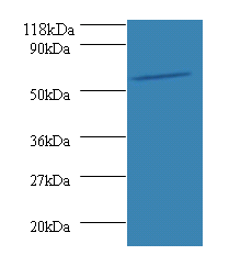 SEPSECS Polyclonal Antibody