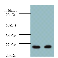 HMGCR Polyclonal Antibody