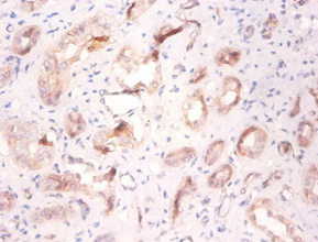 ATP6V1F Polyclonal Antibody