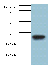rbsK Polyclonal Antibody