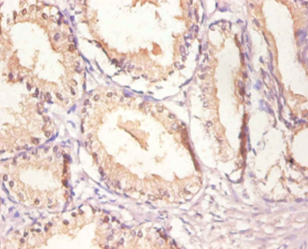 EGFR Polyclonal Antibody