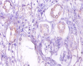 PCK1 Polyclonal Antibody