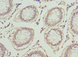 PLA2G7 Polyclonal Antibody