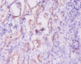 INHA Polyclonal Antibody (50 µl)