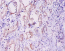 INHA Polyclonal Antibody
