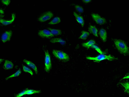 CASR Polyclonal Antibody