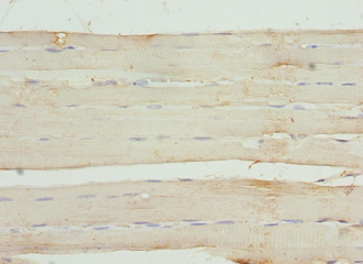 TNNI3 Polyclonal Antibody