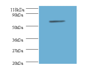 ANXA6 Polyclonal Antibody