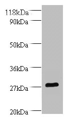 BDNF Polyclonal Antibody (50 µg)