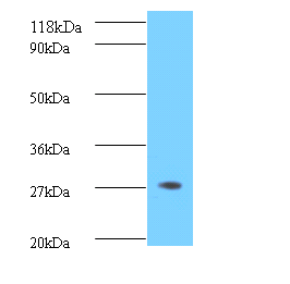 BDNF Polyclonal Antibody