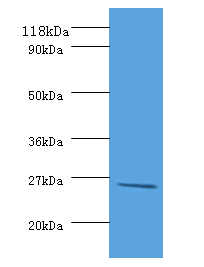 deoD Polyclonal Antibody