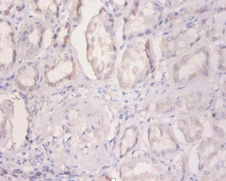 NDUFA2 Polyclonal Antibody