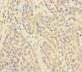 PAPPA Polyclonal Antibody