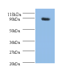 ARHGEF7 Polyclonal Antibody