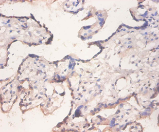 EIF4EBP2 Polyclonal Antibody