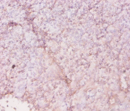 HLA-DRA Polyclonal Antibody