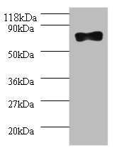 Western blot<br />All lanes: SAMHD1 Polyclonal Antibody at 2ug/ml+293T whole cell lysate<br />Secondary<br />Goat polyclonal to Rabbit IgG at 1/10000 dilution<br />Predicted band size: 72kDa<br />Observed band size: 72kDa<br />