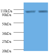HSP90B1 Polyclonal Antibody