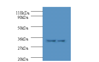 HLA-DPA1 Polyclonal Antibody