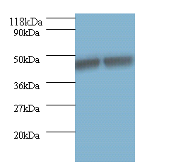 KRT18 Polyclonal Antibody