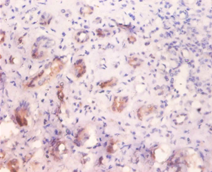 GLA Polyclonal Antibody