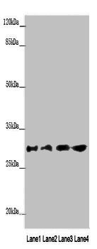 AQP1 Polyclonal Antibody