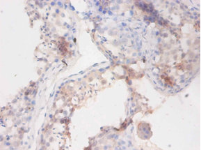 Immunohistochemistry of paraffin-embedded human testis at dilution 1:100