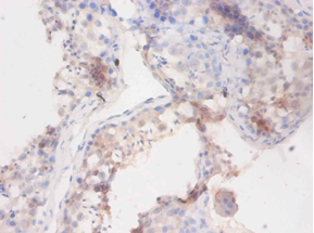 BCHE Polyclonal Antibody