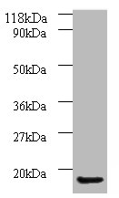 Western blot<br />All lanes: AP1S3 Polyclonal Antibody at 2ug/ml+A549 whole cell lysate<br />Secondary<br />Goat polyclonal to Rabbit IgG at 1/10000 dilution<br />Predicted band size: 19, 20, 13 kDa<br />Observed band size: 18 kDa<br />