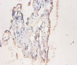 CD59 Polyclonal Antibody