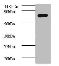 Western blot<br />All lanes: Avpr1a Polyclonal Antibody at 2ug/ml+mouse spleen tissue<br />Secondary<br />Goat polyclonal to Rabbit IgG at 1/10000 dilution<br />Predicted band size: 84 kDa<br />Observed band size: 84 kDa<br />
