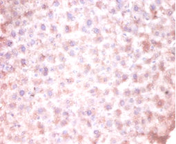 CDKN2AIPNL Polyclonal Antibody (20 µl)