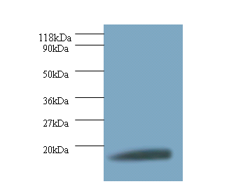 RPS11 Polyclonal Antibody