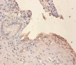 PLTP Polyclonal Antibody