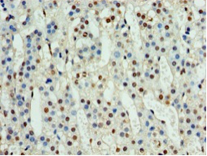 NPHP1 Polyclonal Antibody