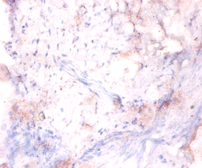 LRRFIP1 Polyclonal Antibody